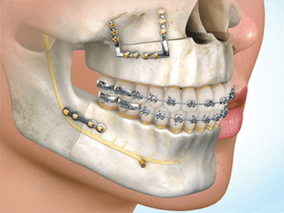 Oral and Maxillofacial Surgery